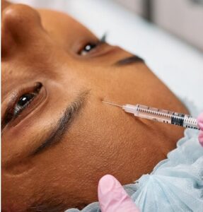 Aplicação de Botox em Itápolis Ibitinga Borborema SP Harmonização Facial Ácido Ialurônico Laser