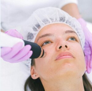 Aplicação de Laser e Botox em Itápolis Ibitinga Borborema Novo Horizonte Taquaritinga SP Harmonização Facial Ácido Ialurônico